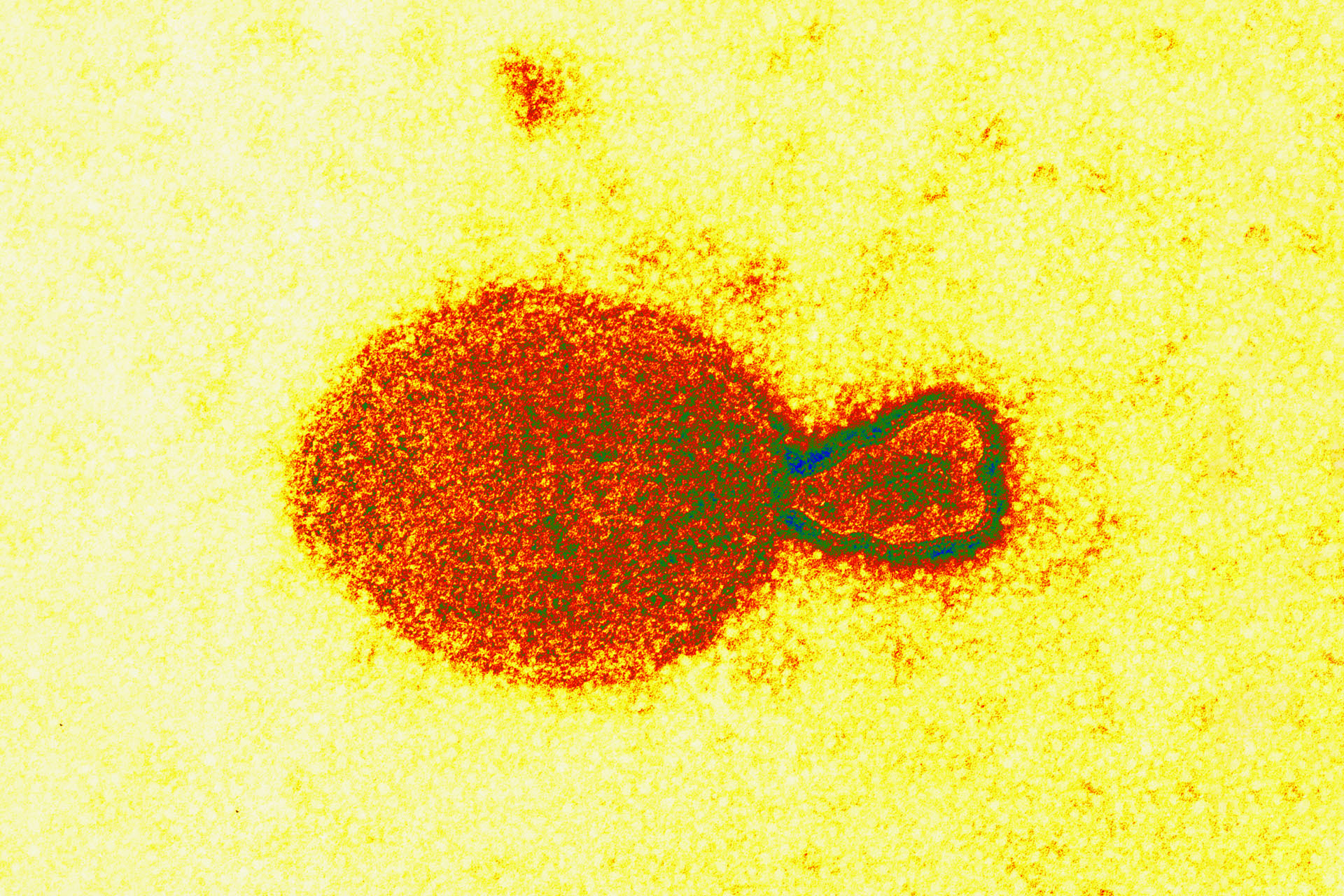 Что известно о генипавирусе «Ланъя»