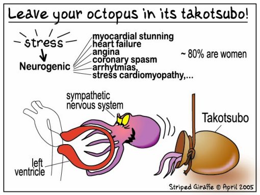 Заключение: Оставь осьминога в его такотсубо! Стресс — нейрогенный (миокардиальный шок, сердечная недостаточность, ангина, коронарный спазм, аритмия, кардиомиопатия). Левый желудочек сердца — симпатическая нервная система — такотсубо