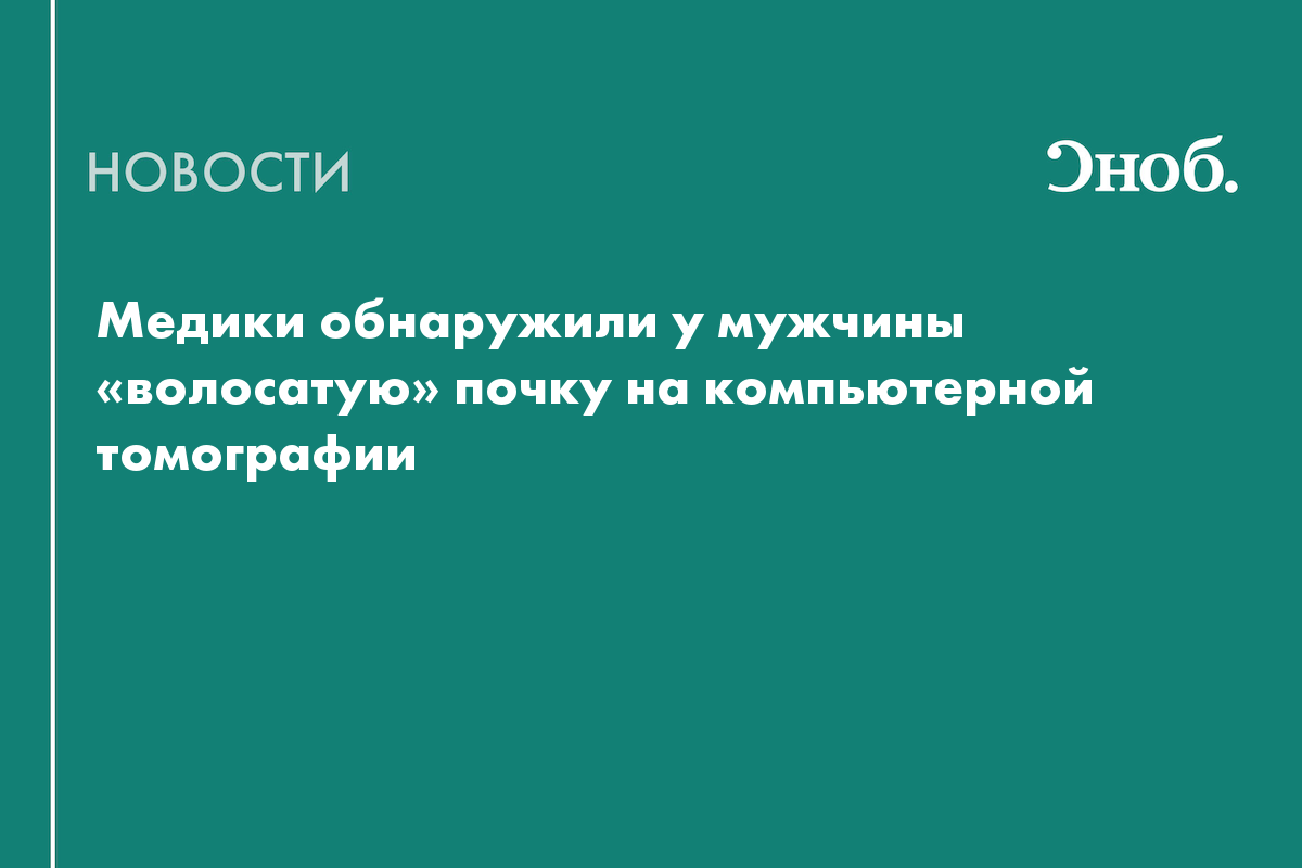 Медики обнаружили у мужчины «волосатую» почку на компьютерной томографии —  Сноб